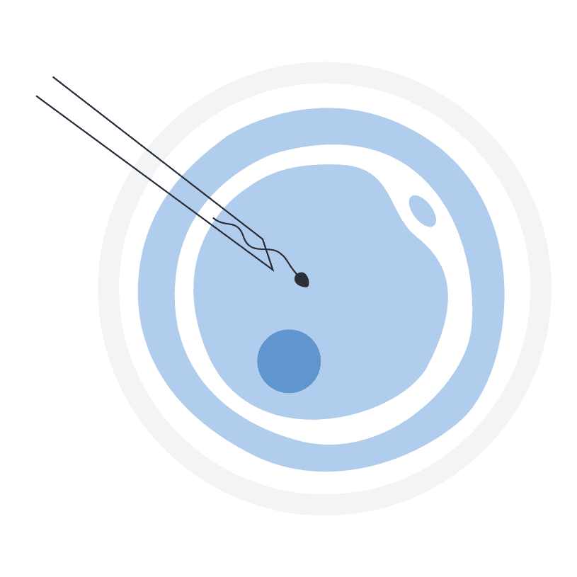 Microinject Needle In-Vitro Fertilization (IVF-ICSI)